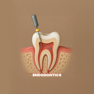 Treatment of infected or damaged tooth pulp to preserve natural teeth.
