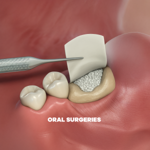 Surgical interventions to prepare or restore the oral foundation.